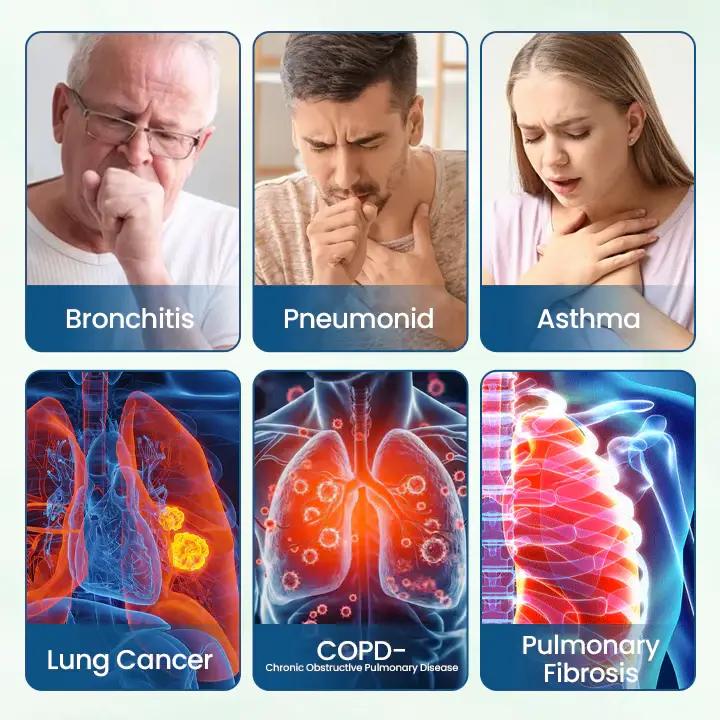 Timilk® NanoHerb Lung Detox Patch 7 Timilk® NanoHerb Lung Detox Patch