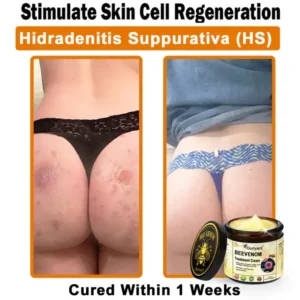 Ourlyard® Botulinum Toxin & Bee Venom Skin Treatment Cream 17 Ourlyard® Botulinum Toxin & Bee Venom Skin Treatment Cream