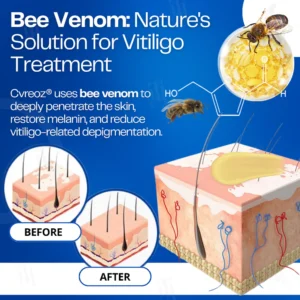 Cvreoz® VitiClear Bee Venom Cream 13 Cvreoz® VitiClear Bee Venom Cream