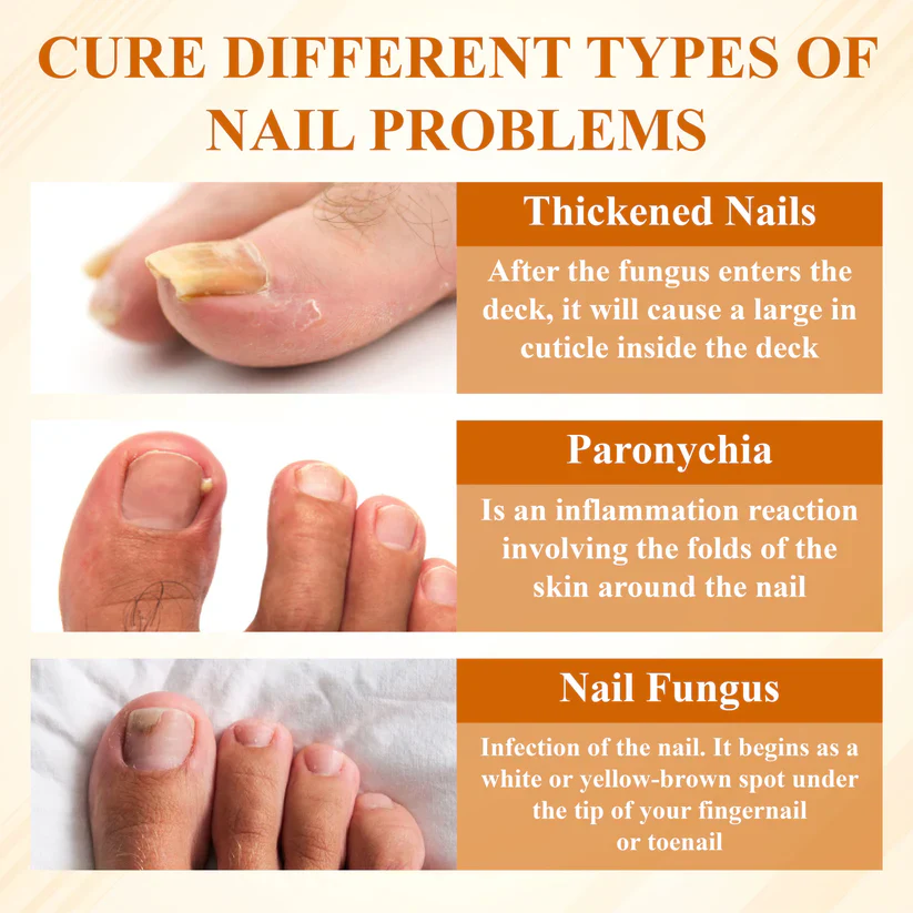 Fivfivgo® Fungiclear Bee Therapy Nail Spray 5 Fivfivgo® Fungiclear Bee Therapy Nail Spray