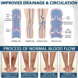 Fivfivgo® VenoHerb Black Cumin Edema Relief Balm 20 Fivfivgo® VenoHerb Black Cumin Edema Relief Balm