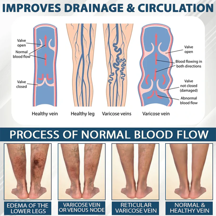 Fivfivgo® VenoHerb Black Cumin Edema Relief Balm 7 Fivfivgo® VenoHerb Black Cumin Edema Relief Balm