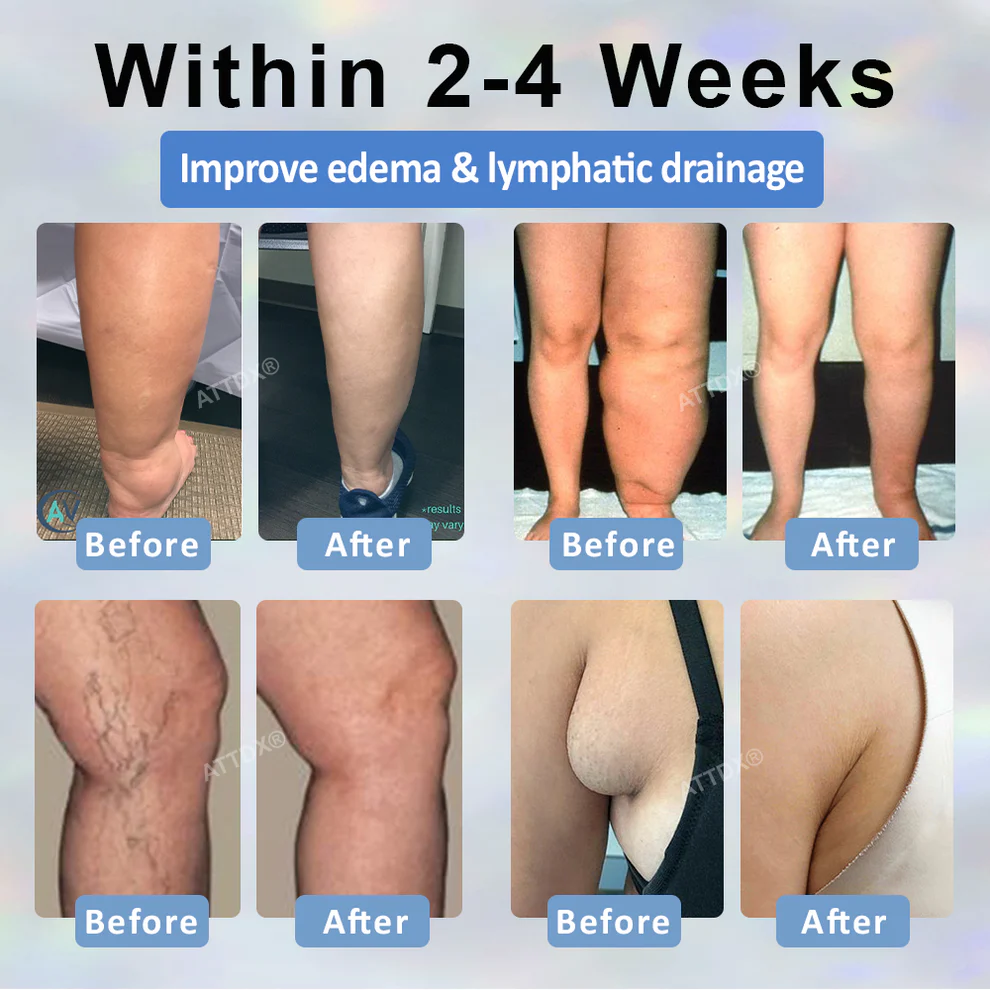 Fivfivgo® Black Cumin Edema Soothing Herbal Cream 3 Fivfivgo® Black Cumin Edema Soothing Herbal Cream