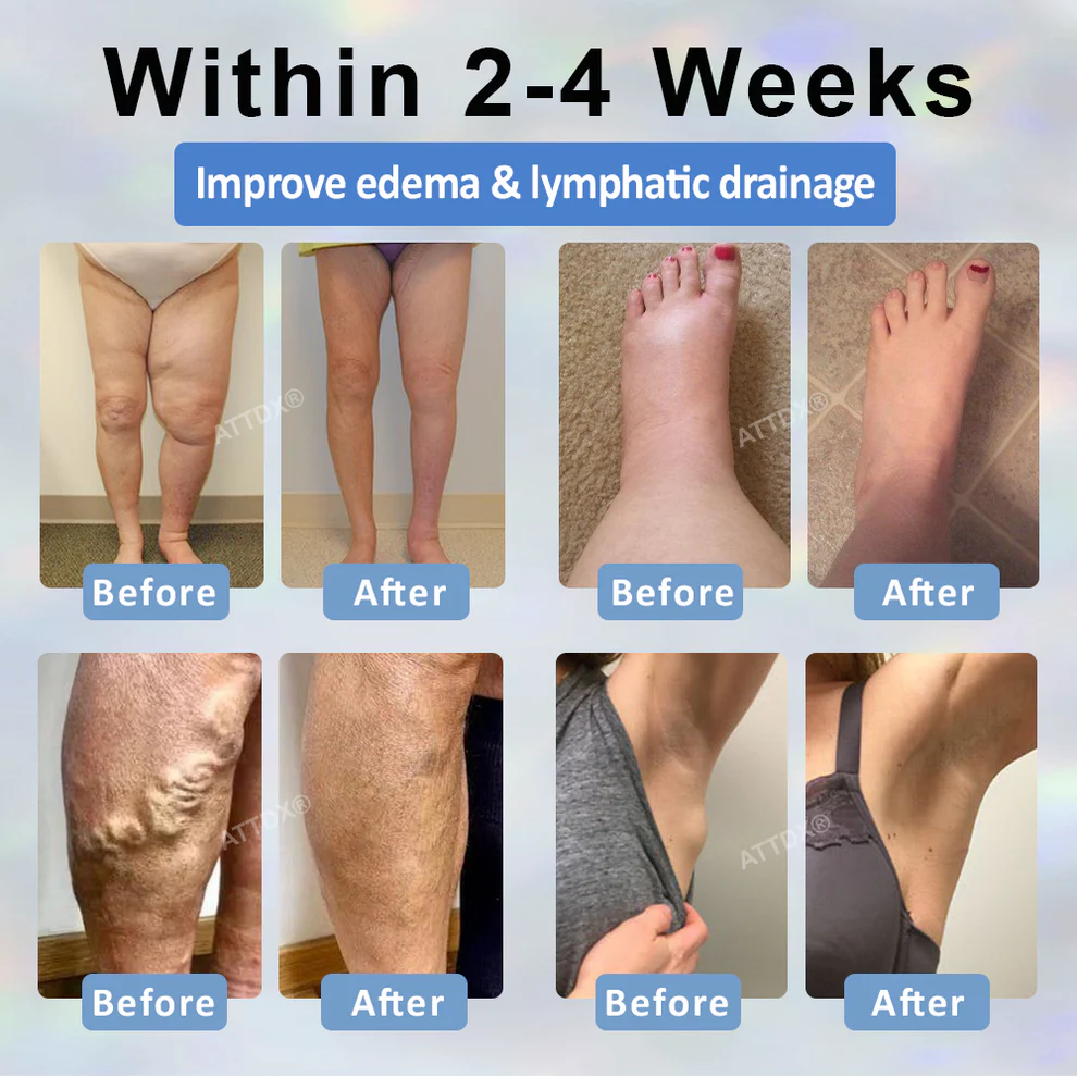 Fivfivgo® Black Cumin Edema Soothing Herbal Cream 4 Fivfivgo® Black Cumin Edema Soothing Herbal Cream