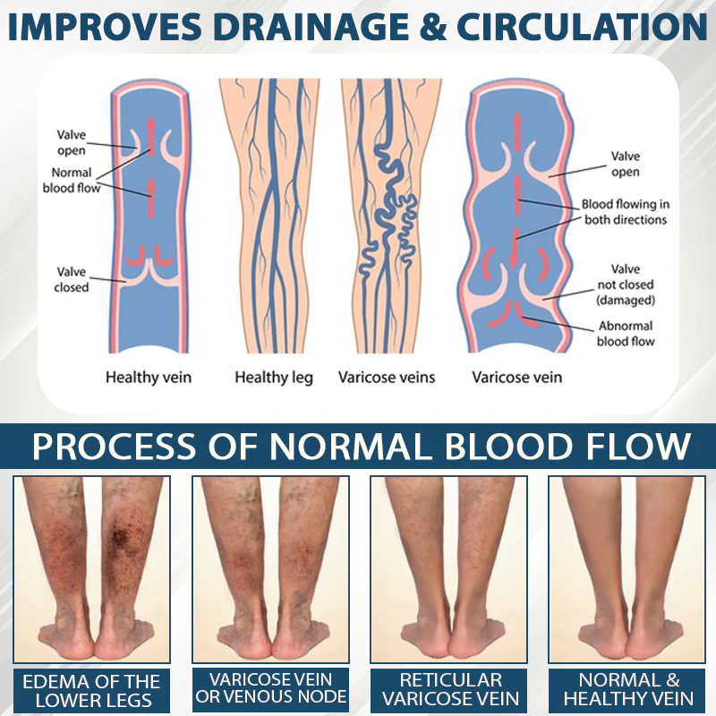 Fivfivgo® Black Cumin Edema Soothing Herbal Cream 8 Fivfivgo® Black Cumin Edema Soothing Herbal Cream