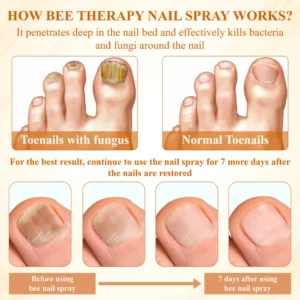 ATTDX® Fungiclear Bee Therapy Nail Spray