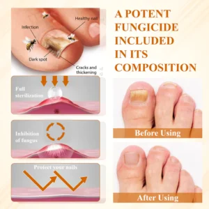 ATTDX® Fungiclear Bee Therapy Nail Spray