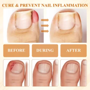 ATTDX® Fungiclear Bee Therapy Nail Spray