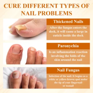 ATTDX® Fungiclear Bee Therapy Nail Spray