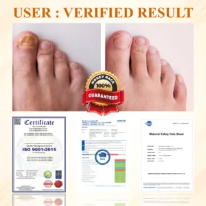 ATTDX® Fungiclear Bee Therapy Nail Spray