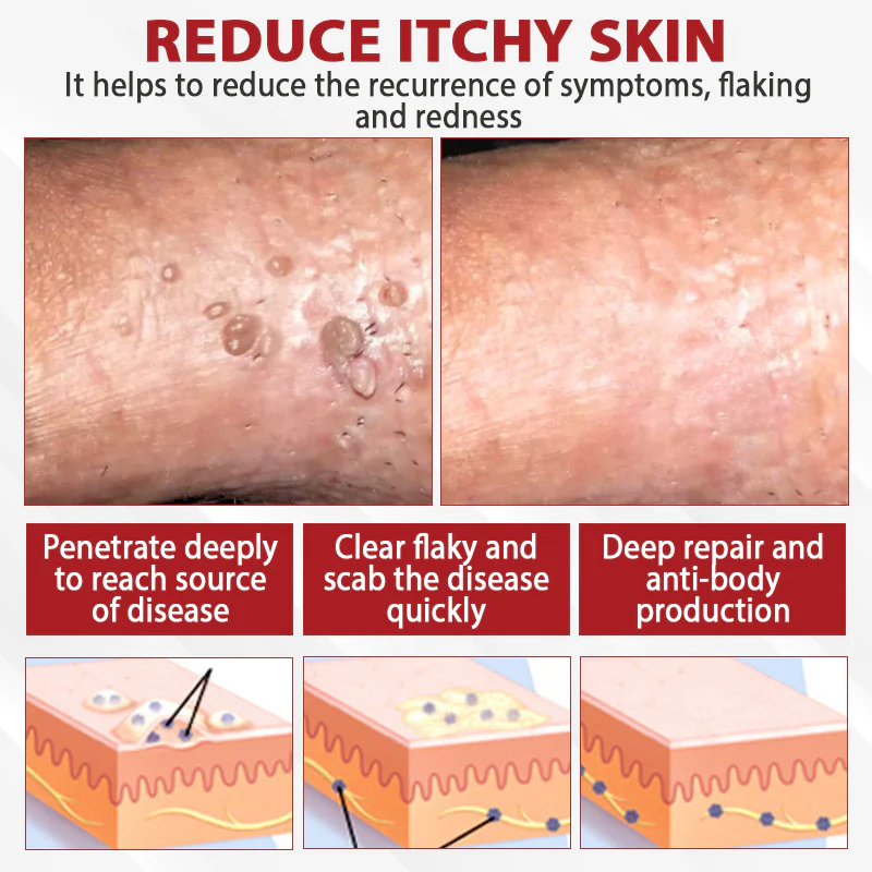 Fivfivgo® Men's HPV Warts Care Spray 7 Fivfivgo® Men's HPV Warts Care Spray