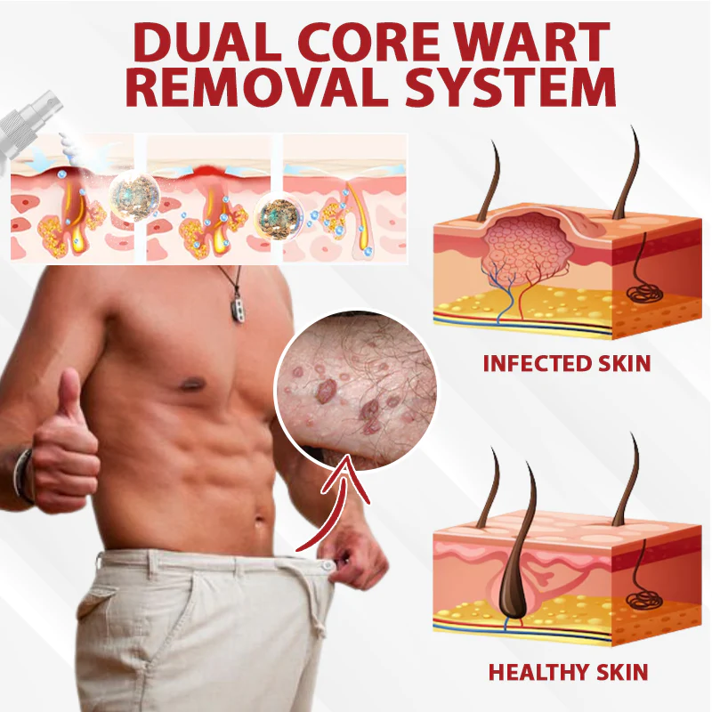 Fivfivgo® Men's HPV Warts Care Spray 6 Fivfivgo® Men's HPV Warts Care Spray