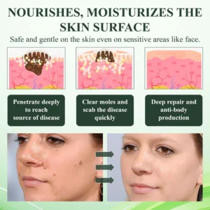 ATTDX® Reedle Shot 100 Tag & Spot Target Advanced Serum 18 ATTDX® Reedle Shot 100 Tag & Spot Target Advanced Serum