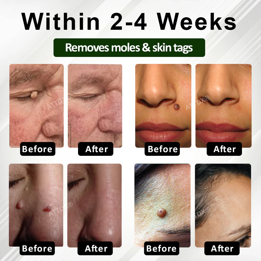 ATTDX® Reedle Shot 100 Tag & Spot Target Advanced Serum 4 ATTDX® Reedle Shot 100 Tag & Spot Target Advanced Serum