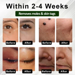 ATTDX® Reedle Shot 100 Tag & Spot Target Advanced Serum 16 ATTDX® Reedle Shot 100 Tag & Spot Target Advanced Serum