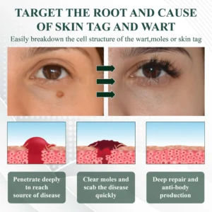 ATTDX® Reedle Shot 100 Tag & Spot Target Advanced Serum 27 ATTDX® Reedle Shot 100 Tag & Spot Target Advanced Serum