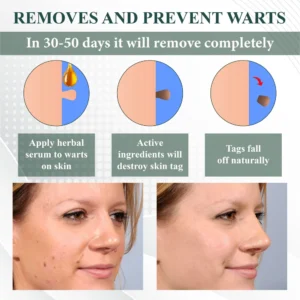 ATTDX® Reedle Shot 100 Tag & Spot Target Advanced Serum 25 ATTDX® Reedle Shot 100 Tag & Spot Target Advanced Serum