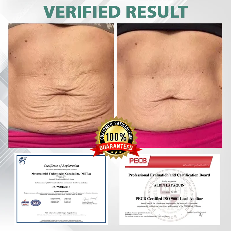 ATTDX® SlimBalance SMGT-GLP-1 NanoDart Patches 10 ATTDX® SlimBalance SMGT-GLP-1 NanoDart Patches