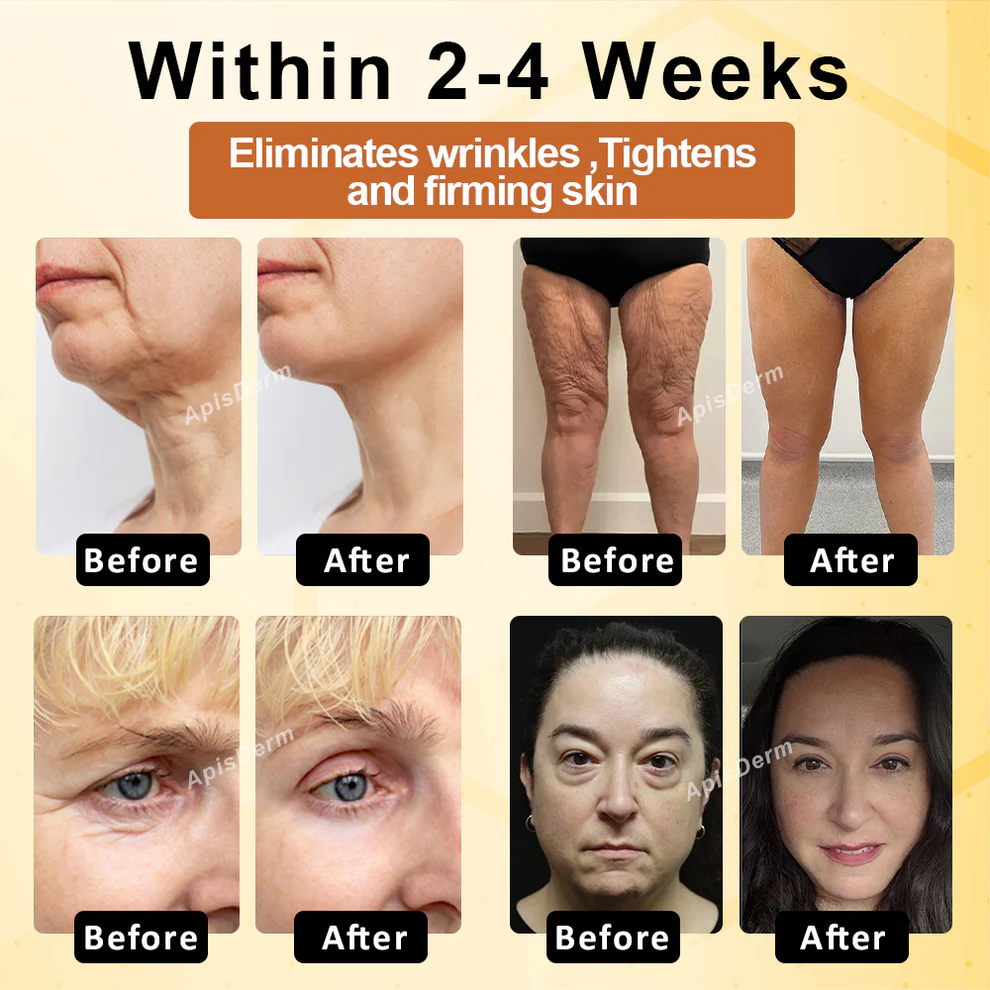 ApisDerm™ BotoxBee Advanced Multi-Action FirmingCream 3 ApisDerm™ BotoxBee Advanced Multi-Action FirmingCream