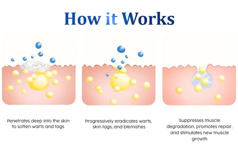 Fivfivgo™ WartsOff Instant Blemish Removal Cream – PREMIUM 2 Fivfivgo™ WartsOff Instant Blemish Removal Cream – PREMIUM