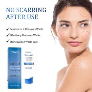 Fivfivgo™ WartsOff Instant Blemish Removal Cream – PREMIUM 19 Fivfivgo™ WartsOff Instant Blemish Removal Cream – PREMIUM