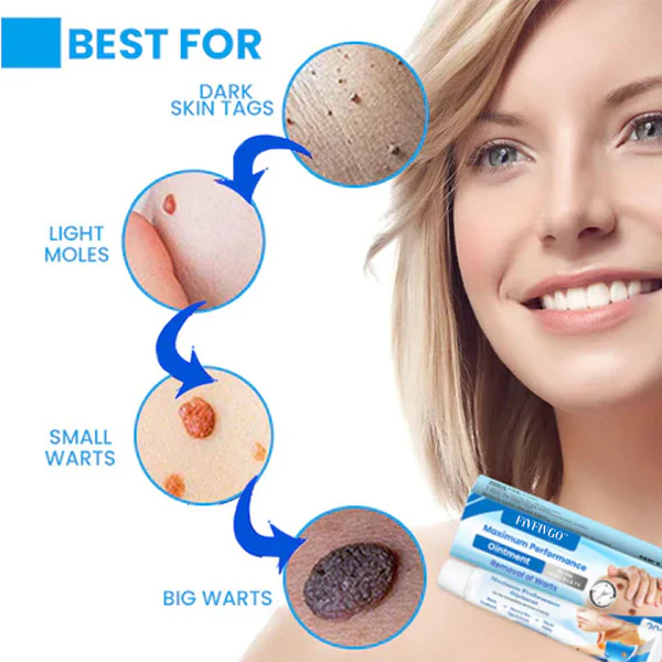 Fivfivgo™ Maximum Performance Ointment for the Immediate removal of Warts 4 Fivfivgo™ Maximum Performance Ointment for the Immediate removal of Warts