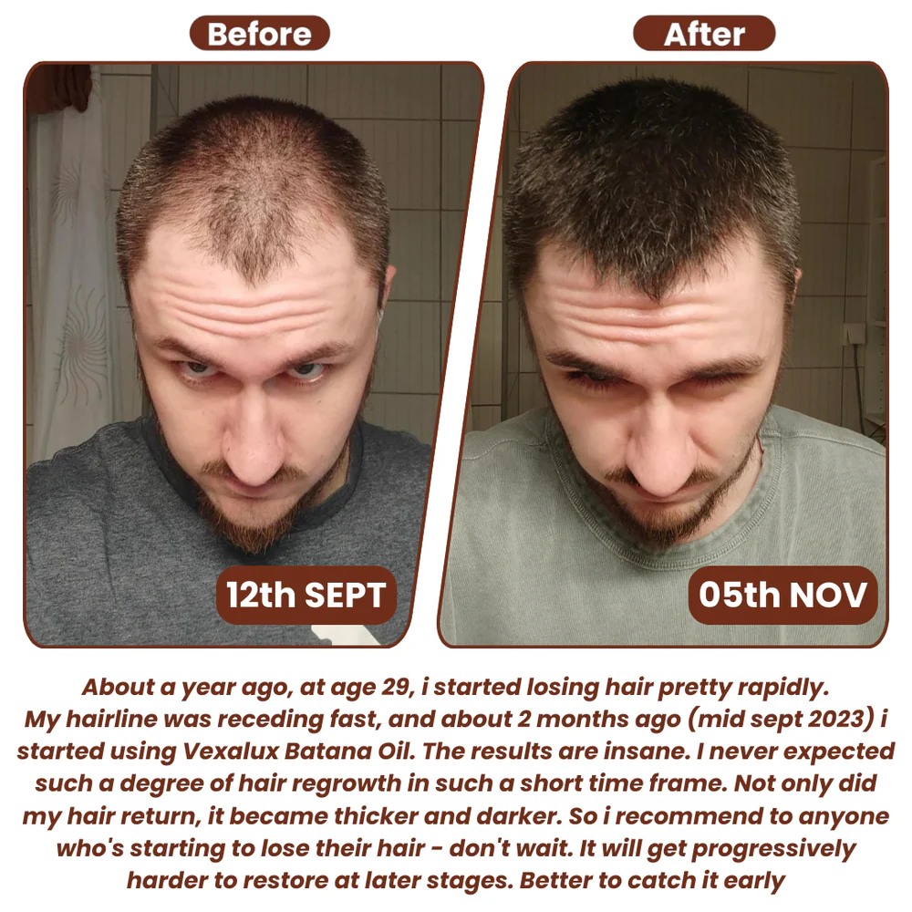 Grows Pure Batana Oil 2 Grows Pure Batana Oil