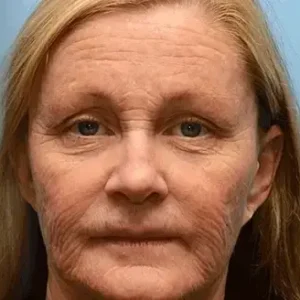 APKAPK™ Bee Venom Skin Treatment Cream 30 APKAPK™ Bee Venom Skin Treatment Cream