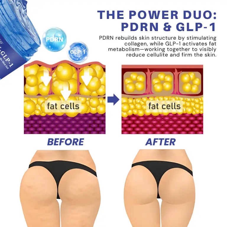 Fivfivgo® PDRN-GLP-1 Cellulite Targeting Reedle Shot Gel 7 Fivfivgo® PDRN-GLP-1 Cellulite Targeting Reedle Shot Gel