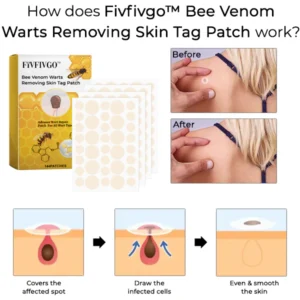 Fivfivgo™ Bee Venom Warts Removing Skin Tag Patch