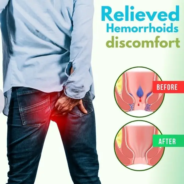 Cvreoz® Herbal Hemorrhoid Spray 4 Cvreoz® Herbal Hemorrhoid Spray