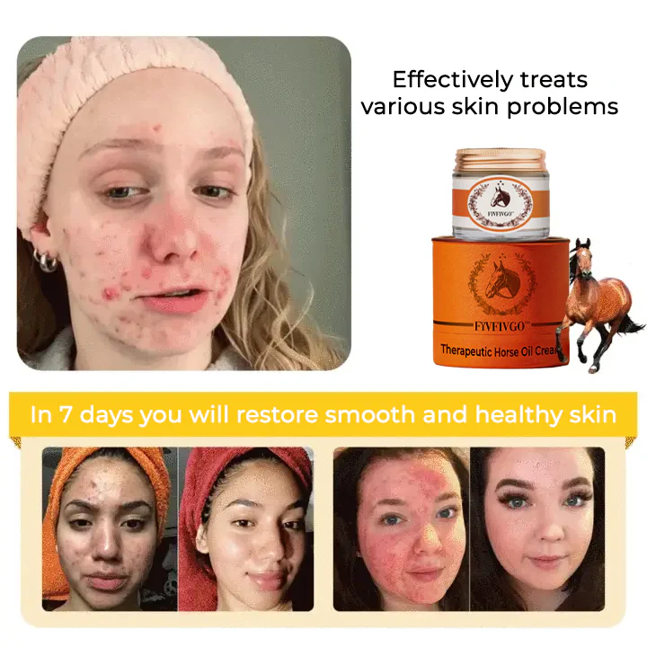 Fivfivgo™ Therapeutic Horse Oil Cream 2 Fivfivgo™ Therapeutic Horse Oil Cream