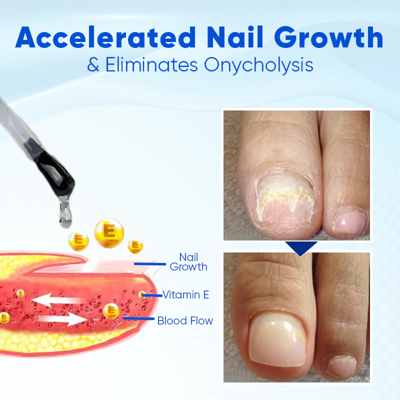 Seurico™ OnyxoGuard Nail Growth and Repair Serum 4 Seurico™ OnyxoGuard Nail Growth and Repair Serum