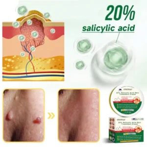 Fivfivgo™ 20% Salicylic Acid Skin Treatment Cream 12 Fivfivgo™ 20% Salicylic Acid Skin Treatment Cream