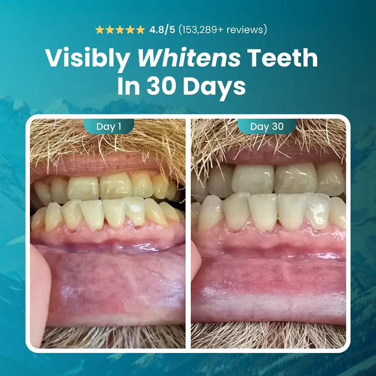 Larineco™️ – Remineralizing Gum 5 Larineco™️ – Remineralizing Gum