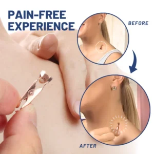 Fivfivgo™ Mole Removal Germ-Free Tongs 9 Fivfivgo™ Mole Removal Germ-Free Tongs