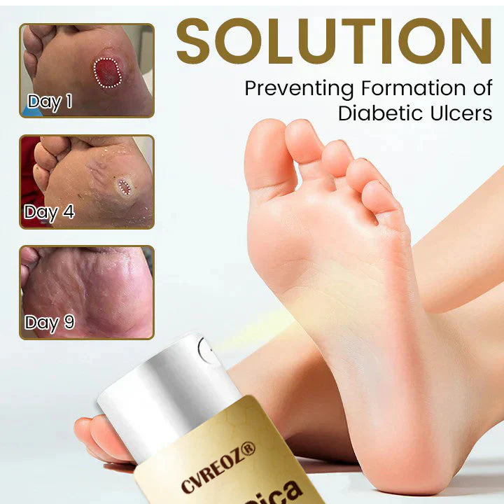 CVREOZ® DiaCure Bee Venom & Centella Diabetic Foot Ulcer Spray 4 CVREOZ® DiaCure Bee Venom & Centella Diabetic Foot Ulcer Spray