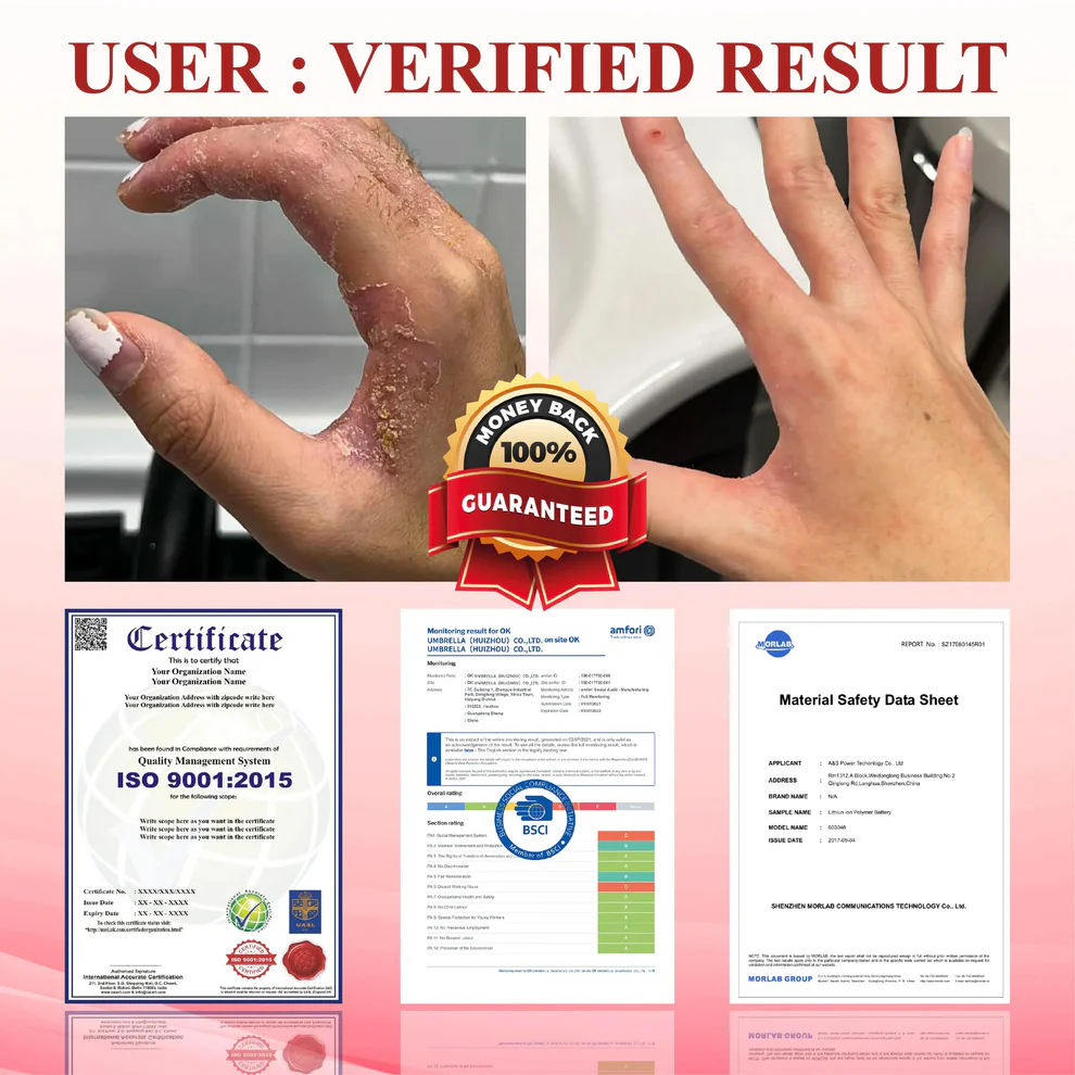 CVREOZ® GlucoseGuard Skin Rescue Cream 9 CVREOZ® GlucoseGuard Skin Rescue Cream