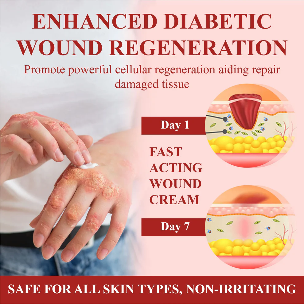 CVREOZ® GlucoseGuard Skin Rescue Cream 4 CVREOZ® GlucoseGuard Skin Rescue Cream