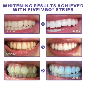 Fivfivgo® Purple Whitening Teeth Strips 13 Fivfivgo® Purple Whitening Teeth Strips