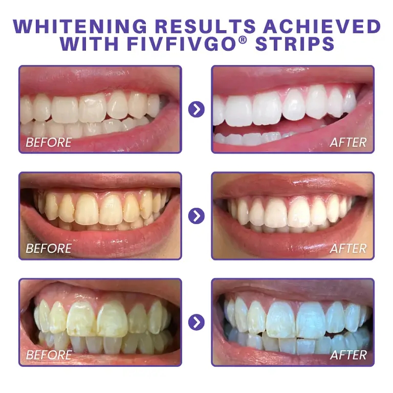 Fivfivgo® Purple Whitening Teeth Strips 6 Fivfivgo® Purple Whitening Teeth Strips
