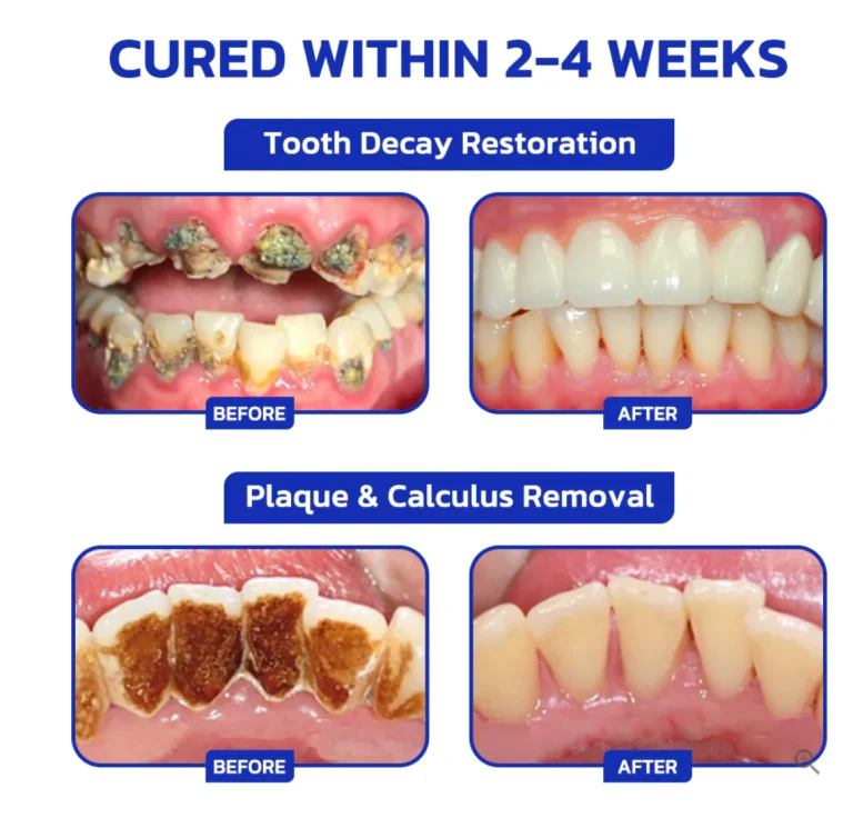 Fivfivgo™ Bee Venom Treatment Powder for Oral Use 3 Fivfivgo™ Bee Venom Treatment Powder for Oral Use