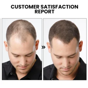 Fivfivgo™ New ShougaGRO Japanese Hair Growth Spray 14 Fivfivgo™ New ShougaGRO Japanese Hair Growth Spray