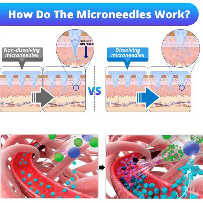Dowshow® Nano Microneedle Patch 5 Dowshow® Nano Microneedle Patch
