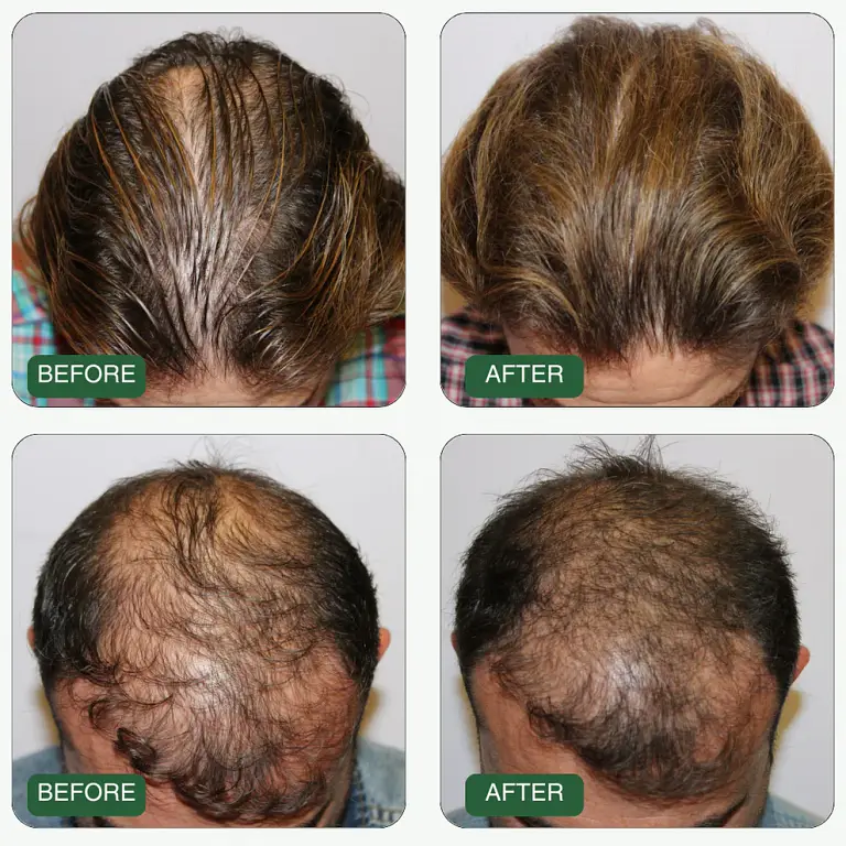 Growth Activation Serum™ – Sale 3 Growth Activation Serum™ – Sale