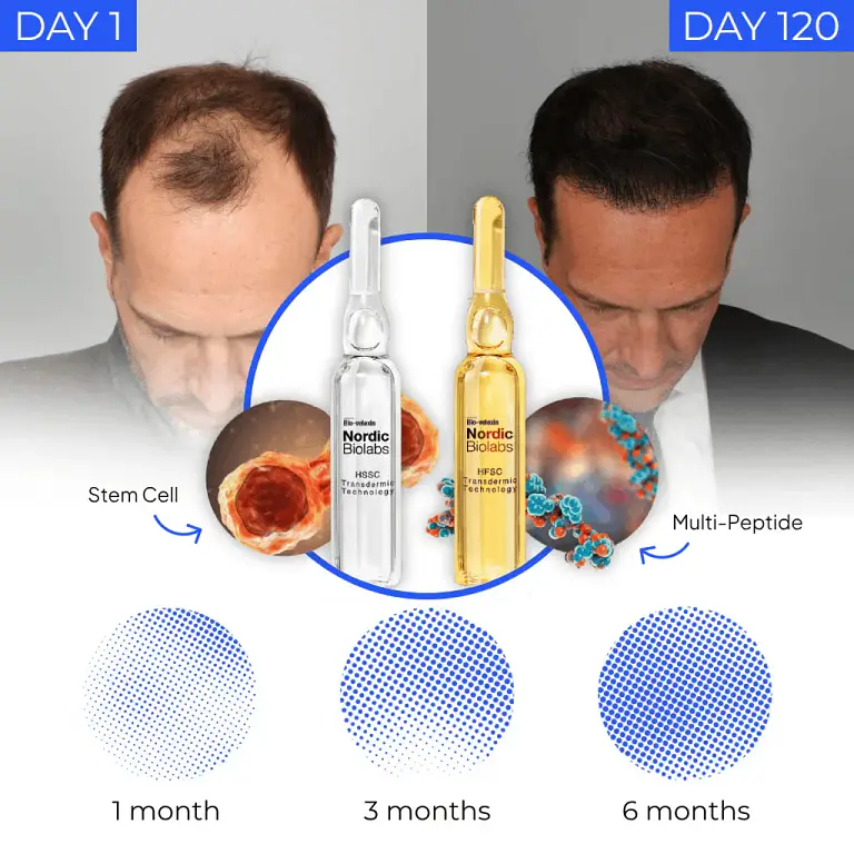 Regrow your hair in 120 days with STEM Cell Complete Hair Cycle Solution 2.0 or your money back 1 Regrow your hair in 120 days with STEM Cell Complete Hair Cycle Solution 2.0 or your money back