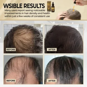 Cvreoz® Biotin Hair Essential Oil