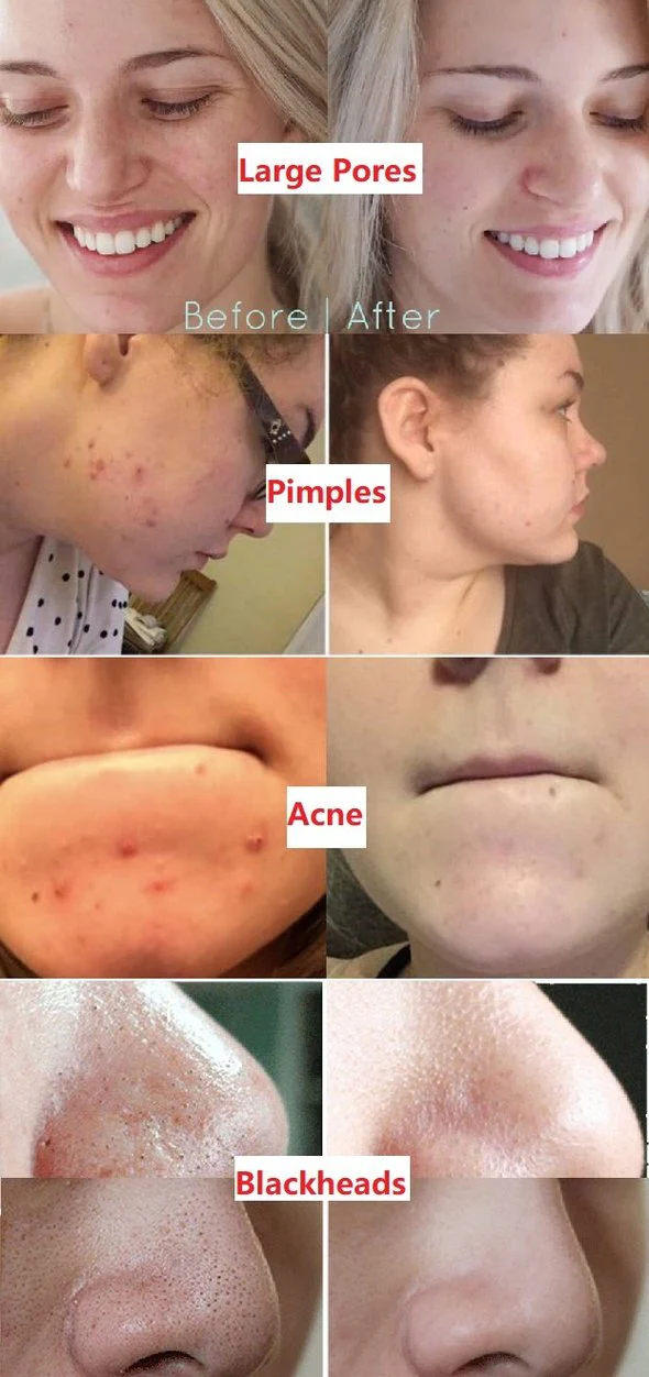 Diystar™ Green Tea Deep Cleanse Mask Stick 10 Diystar™ Green Tea Deep Cleanse Mask Stick