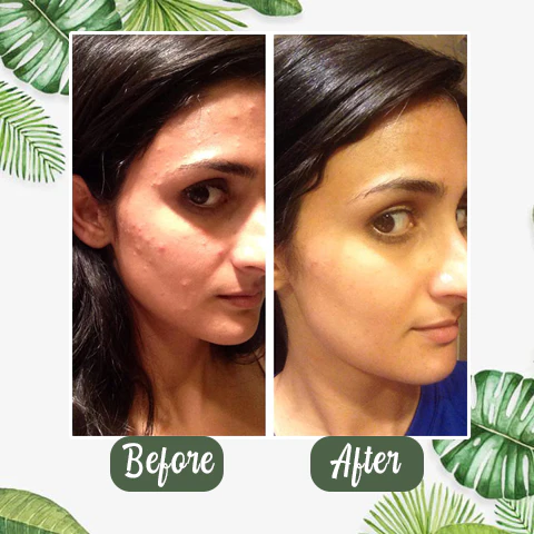 Diystar™ Green Tea Deep Cleanse Mask Stick 12 Diystar™ Green Tea Deep Cleanse Mask Stick