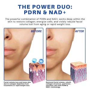 ATTDX® PDRN-NAD+ Cica Reedle Shot Serum 13 ATTDX® PDRN-NAD+ Cica Reedle Shot Serum